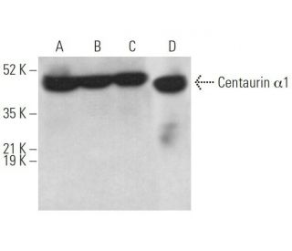 Centaurin &alpha;1 Antibody (G-4) - Western Blotting - Image 373195 