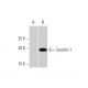 Centrin-1 Antibody (2A6) - Western Blotting - Image 352104 