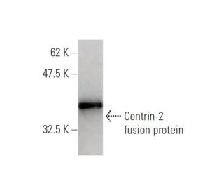 western blotting image from recommended Centrin-2 (3F8) monoclonal antibody replacement. Image 348453