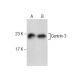 Centrin-3 Antibody (SS12) - Western Blotting - Image 282473 