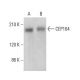 CEP164 Antibody (E-9) - Western Blotting - Image 374405