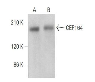 CEP164 Antibody (E-9) - Western Blotting - Image 374405Each CRISPR/Cas9 Knockout (KO) Plasmid product consists of a pool of 3 plasmids designed to ensure identification and cleavage of a specific gene for maximum knockout efficiency. Each plasmid encodes a unique 20 nt sequence derived from the GeCKO (v2) library.