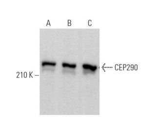 CEP290 Antibody (G-4) - Western Blotting - Image 371149 