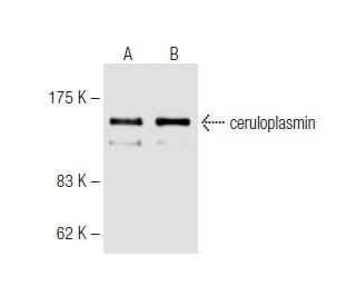 ceruloplasmin Antibody (3B11) - Western Blotting - Image 62819