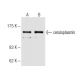 ceruloplasmin Antibody (3B11) - Western Blotting - Image 62819