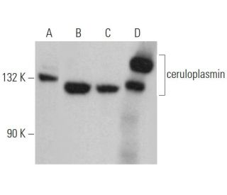 ceruloplasmin Antibody (H-3) - Western Blotting - Image 363444Each CRISPR/Cas9 Knockout (KO) Plasmid product consists of a pool of 3 plasmids designed to ensure identification and cleavage of a specific gene for maximum knockout efficiency. Each plasmid encodes a unique 20 nt sequence derived from the GeCKO (v2) library.