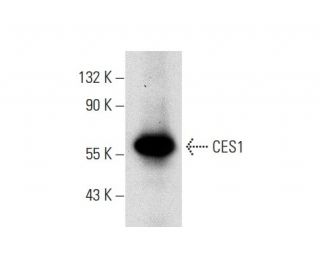 CES1 Antibody (A-11) - Western Blotting - Image 303409 