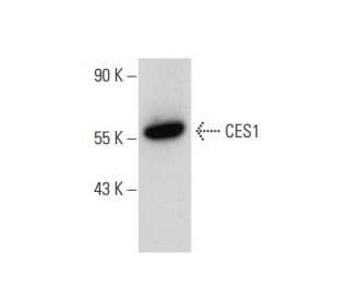 CES1 Antibody (B-4) - Western Blotting - Image 303411 