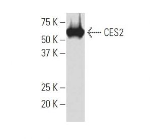 CES2 Antibody (G5) - Western Blotting - Image 34057 