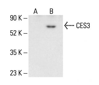 CES3 Antibody (B-5) - Western Blotting - Image 404946
