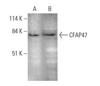 CFAP47 Antibody (G-12) - Western Blotting - Image 351673 