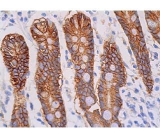 P様 CFTR Antibody (A-3) | SCBT - Santa Cruz Biotechnology