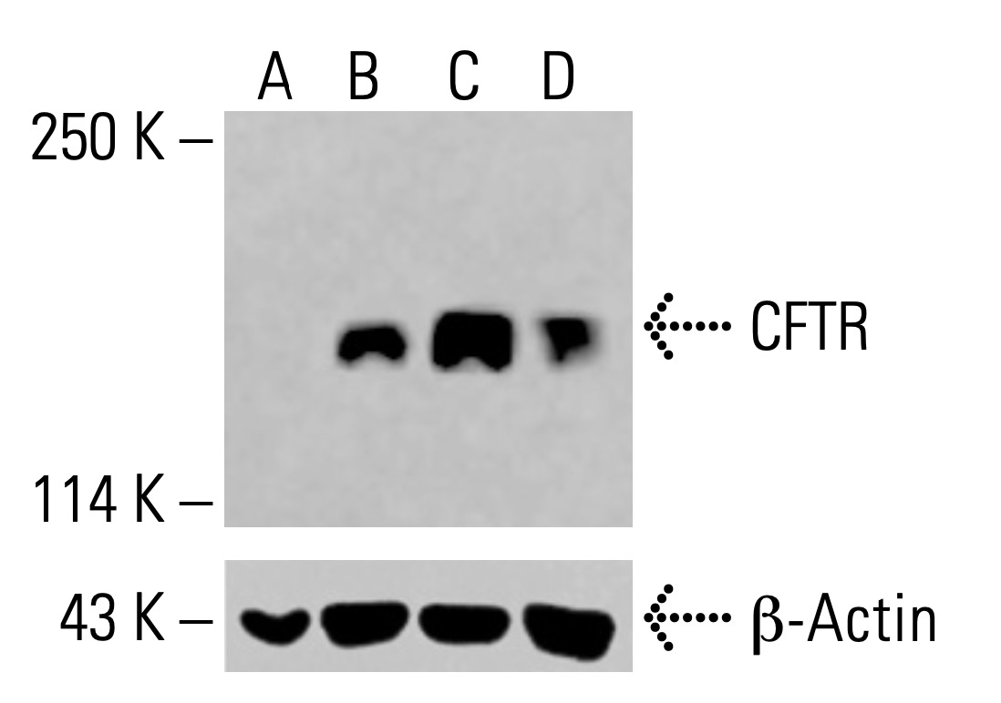 CFTR Antibody (A-3) | SCBT - Santa Cruz Biotechnology