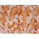 CFTR Antibody (GA1) - Immunohistochemistry - Image 293317