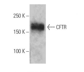 CFTR Antibody (GA1) - Western Blotting - Image 4621 