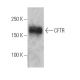 CFTR Antibody (GA1) - Western Blotting - Image 4621 