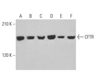 western blotting image from recommended CFTR (A-3) monoclonal antibody replacement. Image 377950