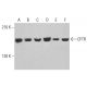 western blotting image from recommended CFTR (A-3) monoclonal antibody replacement. Image 377950