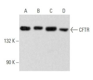 CFTR Antibody (A-3) - Western Blotting - Image 354890