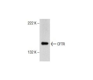 CFTR Antibody (A-3) - Western Blotting - Image 157827 