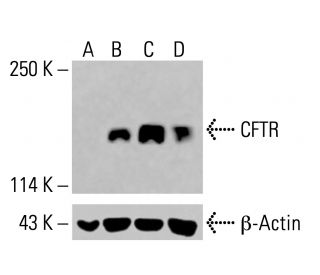 CFTR Antibody (A-3) - Western Blotting - Image 414834