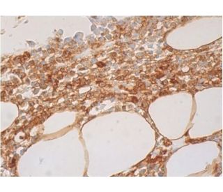 cGAS Antibody (C-1) - Immunohistochemistry - Image 384175 