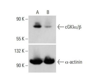 cGKIα/β CRISPR/Cas9 KO Plasmid (h): sc-401593. Western blot analysis of human cGKIα/β expression in empty vector control (Each CRISPR/Cas9 Knockout (KO) Plasmid product consists of a pool of 3 plasmids designed to ensure identification and cleavage of a specific gene for maximum knockout efficiency. Each plasmid encodes a unique 20 nt sequence derived from the GeCKO (v2) library.