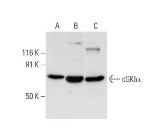 western blotting image from recommended cGKI&alpha; (F-5) monoclonal antibody replacement. Image 300120