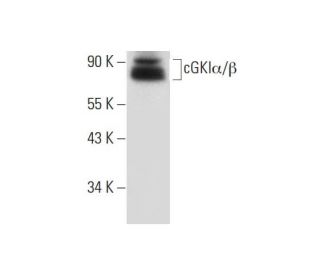 cGKI&alpha;/&beta; Antibody (E-1) - Western Blotting - Image 300121 