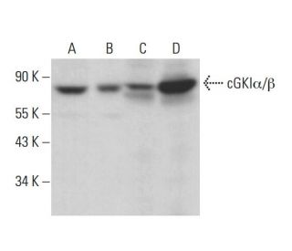 cGKI&alpha;/&beta; Antibody (G-3) - Western Blotting - Image 378186 