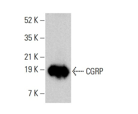 CGRP 항체 (4901): sc-57053