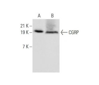 western blotting image from recommended CGRP (4901) monoclonal antibody replacement. Image 323550