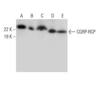 CGRP-RCP Antibody (D-1) - Western Blotting - Image 294801 