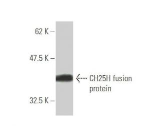 CH25H Antibody (1G8) - Western Blotting - Image 348983Each CRISPR/Cas9 Knockout (KO) Plasmid product consists of a pool of 3 plasmids designed to ensure identification and cleavage of a specific gene for maximum knockout efficiency. Each plasmid encodes a unique 20 nt sequence derived from the GeCKO (v2) library.