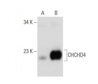 CHCHD4 Antibody (C-12) - Western Blotting - Image 138350Each CRISPR/Cas9 Knockout (KO) Plasmid product consists of a pool of 3 plasmids designed to ensure identification and cleavage of a specific gene for maximum knockout efficiency. Each plasmid encodes a unique 20 nt sequence derived from the GeCKO (v2) library.