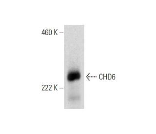 CHD6 Antibody (A-5) - Western Blotting - Image 295767Each CRISPR/Cas9 Knockout (KO) Plasmid product consists of a pool of 3 plasmids designed to ensure identification and cleavage of a specific gene for maximum knockout efficiency. Each plasmid encodes a unique 20 nt sequence derived from the GeCKO (v2) library.
