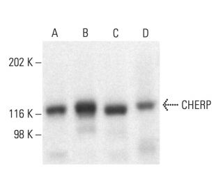 CHERP Antibody (SS5) - Western Blotting - Image 404266 