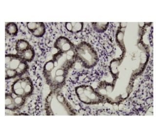 Chfr Antibody (L2) - Immunohistochemistry - Image 35901
