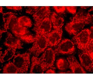 HSP 60 (K-19): sc-1722. Immunofluorescence staining of formalin-fixed A-431 cells showing mitochondrial localization. Dete