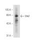 Chk2 Antibody (19) - Western Blotting - Image 93774