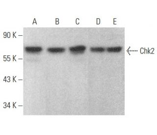 Chk2 Antibody (DCS-270) - Western Blotting - Image 354015 