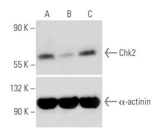 Chk2 siRNA (h): sc-29271. Western blot analysis of human Chk2 expression in non-transfected (A), Chk2 shRNA Plasmid transf 