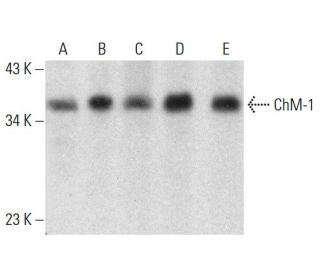 ChM-1 Antibody (H-10) - Western Blotting - Image 384474SAM Transcription Activation: SAM system utilizing dCas9-VP64, MS2-P65-HSF1, and sgRNA for precise gene transcription activation.