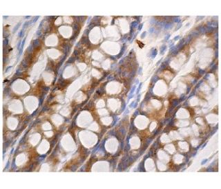 cHMGCS Antibody (H-9) - Immunohistochemistry - Image 160976 
