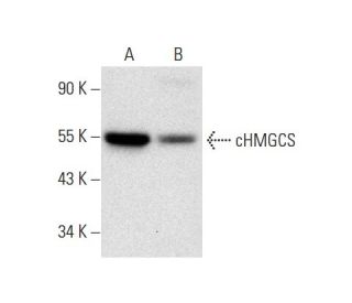 cHMGCS Antibody (C-8) - Western Blotting - Image 296896Each CRISPR/Cas9 Knockout (KO) Plasmid product consists of a pool of 3 plasmids designed to ensure identification and cleavage of a specific gene for maximum knockout efficiency. Each plasmid encodes a unique 20 nt sequence derived from the GeCKO (v2) library.