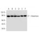 western blotting image from recommended choactase (E-7) monoclonal antibody replacement. Image 312945