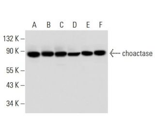 choactase Antibody (E-7) - Western Blotting - Image 312945 