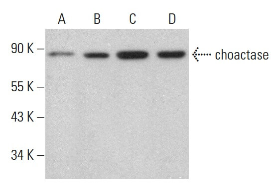 glutathione oxidase glutathione adduct of 4-hne Quantitative Analysis of Glutathione and Carnosine Adducts with 4-Hydroxy-2-nonenal  in Muscle in a hSOD1G93A ALS Rat Model