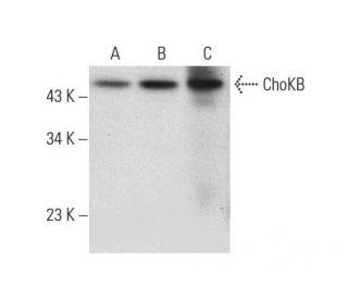 ChoKB Antibody (G-12) - Western Blotting - Image 309503 
