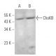 ChoKB Antibody (G-12) - Western Blotting - Image 369947